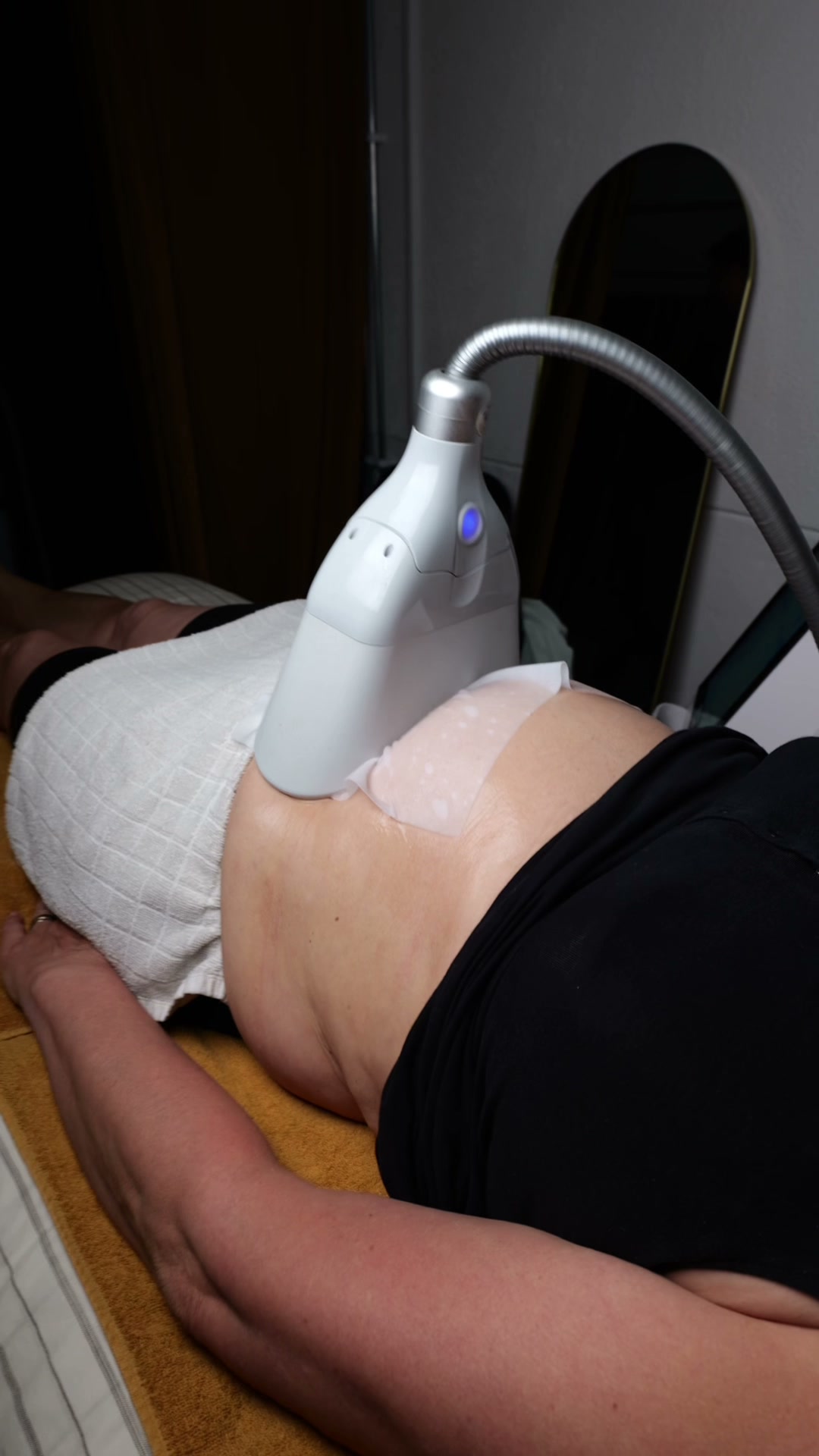 Kryolipolyse Schritt 1: Applikator anlegen